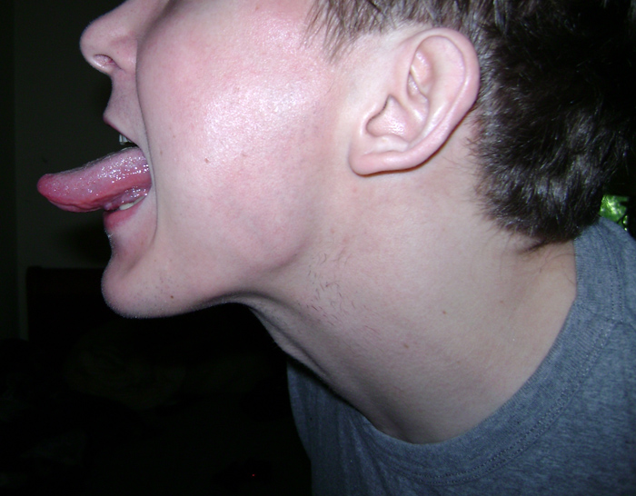 Tongue